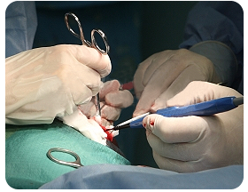 Surgical Implant